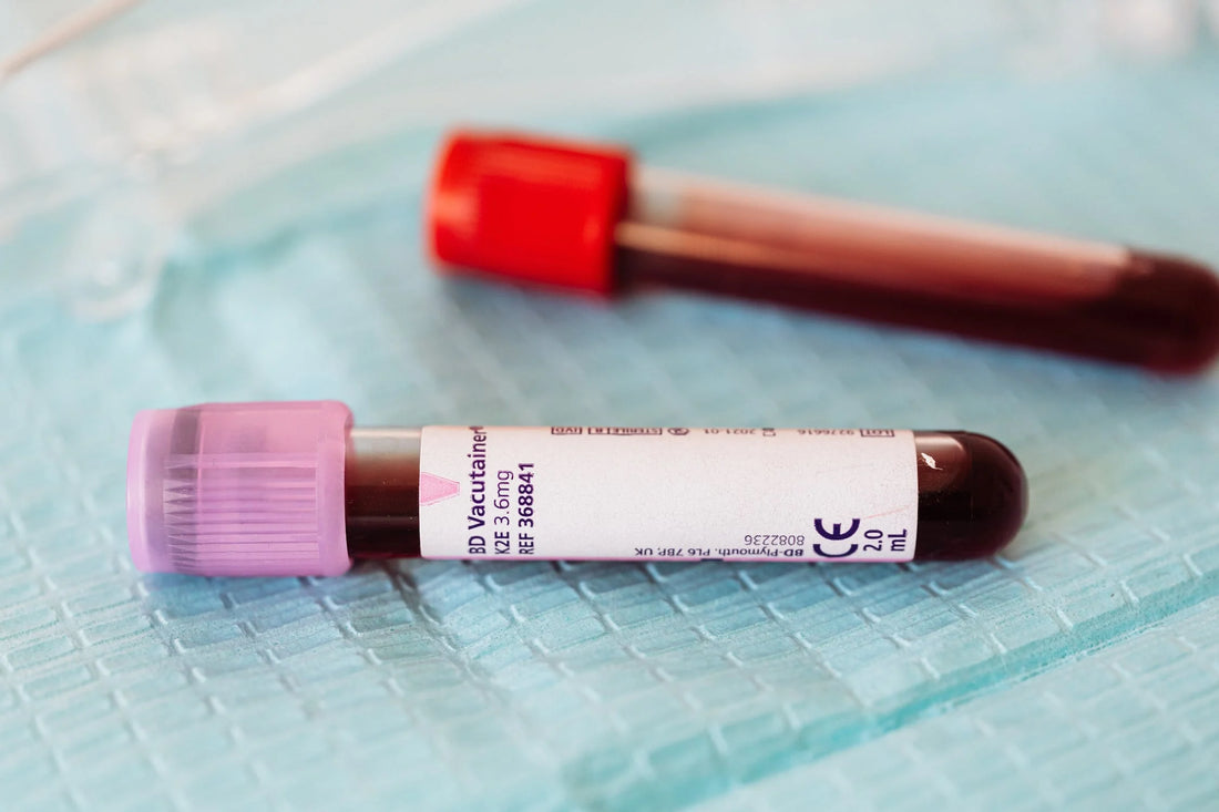 Revolutionizing Healthcare: The Rise of At-Home Blood Tests